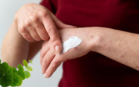  Blastoestimulina al detalle: Qué, cómo, cuándo y por qué usar este cicatrizante