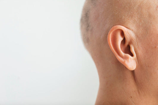 Alopecia autoinmune: Causas, síntomas y tratamientos para recuperar la salud capilar