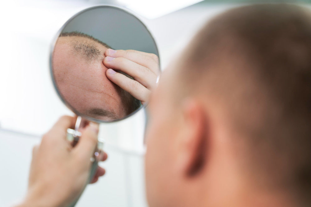 Tipos de alopecia: Cómo identificarlos, causas y tratamientos desde la farmacia